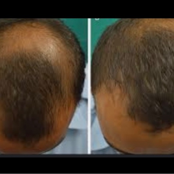 Hair Growth Secrets Moringa - Picture 3 of 5